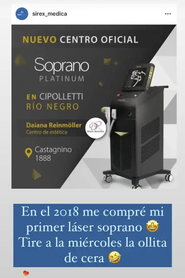 Mi primera gran inversión en tecnología láser